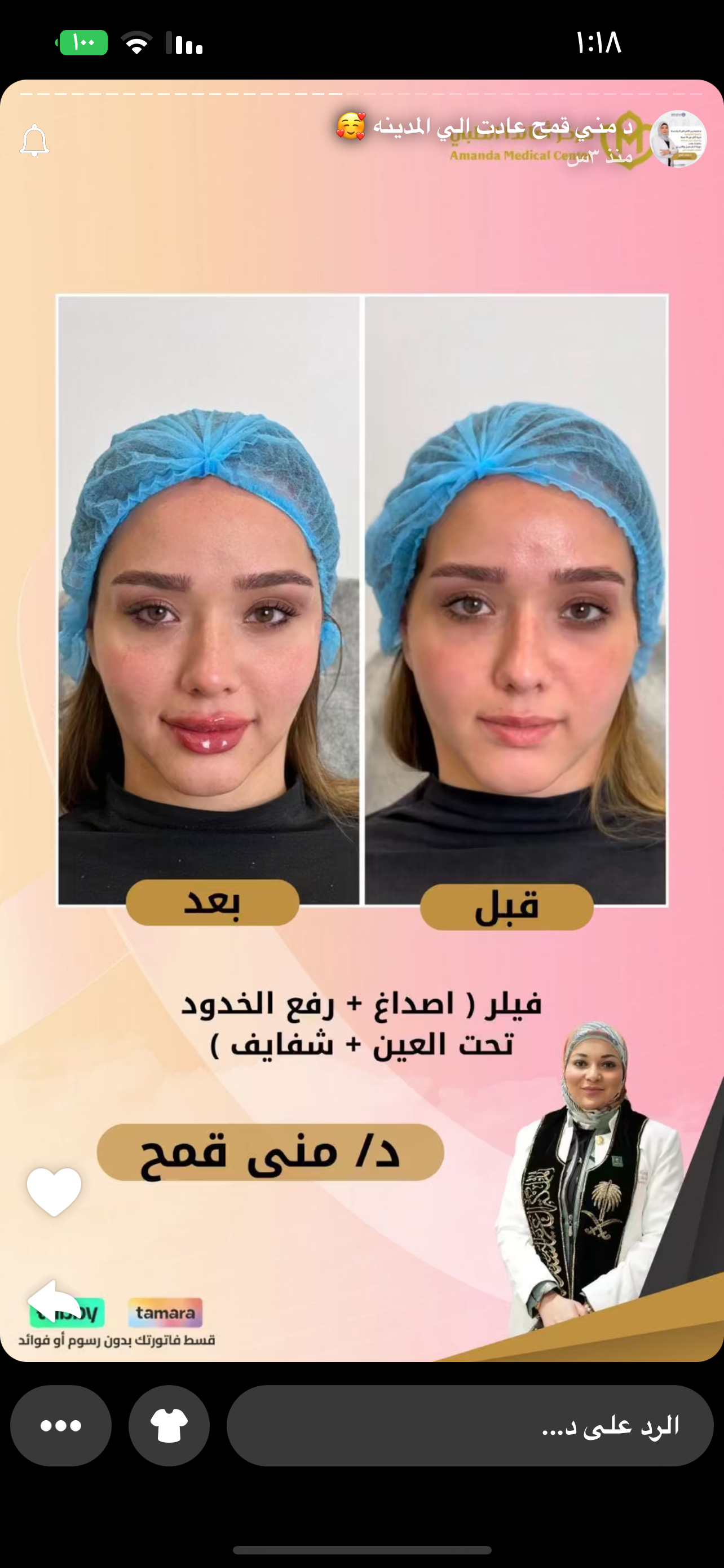 المودل / ابرار موسى